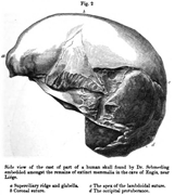 Vista lateral del molde de un cráneo humano